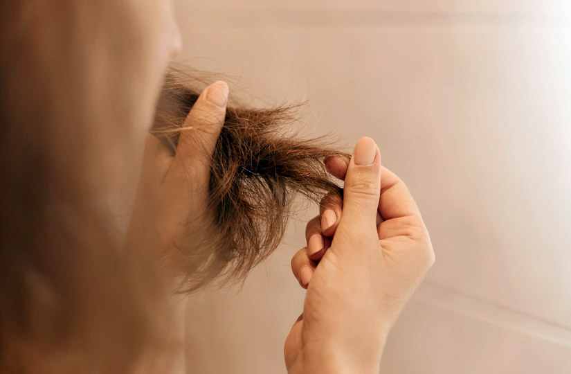 Какие витамины для волос лучшие при выпадении и перхоти и какие продукты  полезны для здоровья волос
